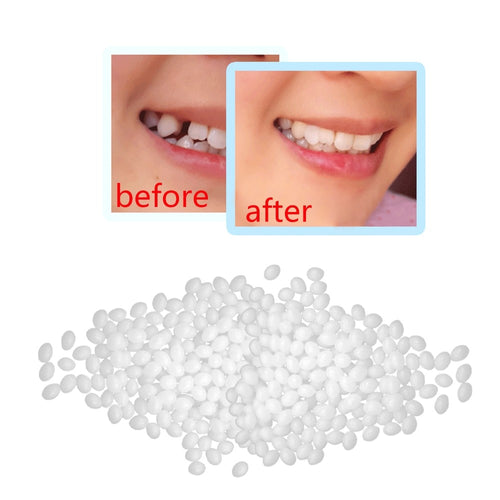 10g Denture Solid Glue Dental Restoration Temporary Tooth Repair Kit Teeth And Gaps FalseTeeth Solid Glue Denture Adhesive #40